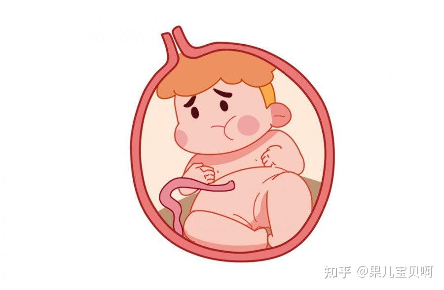 备孕的注意事项_女性备孕需要注意什么_备孕女性注意事项