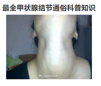 促甲状腺激素偏高 备孕_备孕促甲状腺激素偏高影响_游离甲状腺素偏低 促甲状腺激素偏高