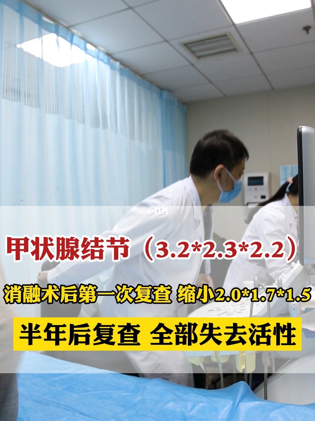 所有甲状腺结节患者均应检测血清促甲状腺激素和分化型