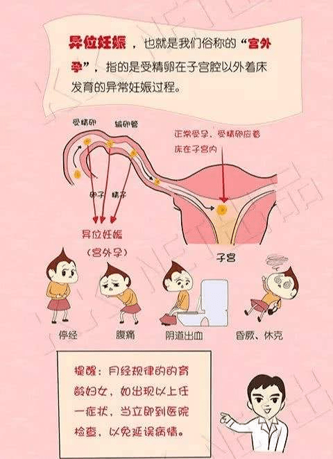 宫外孕女性备孕计划_宫外孕后怎样调理身体备孕_宫外孕后怎么备孕