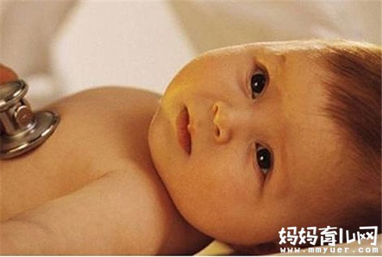 关注母乳性黄疸怎么治疗 转变喂养方式是重点