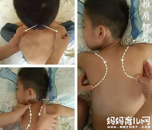 治疗小儿咳嗽的推拿手法图解  有图有真相 一看就懂！