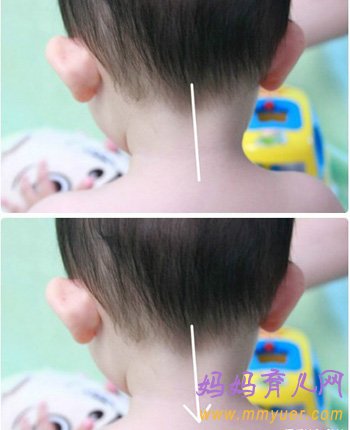治疗百病的中医小儿推拿手法（图解）