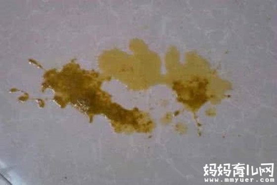 从宝宝拉稀水蛋花样图片 了解宝宝腹泻的症状及原因