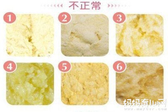 教你如何应对宝宝拉稀水蛋花样的特殊情况（图片）
