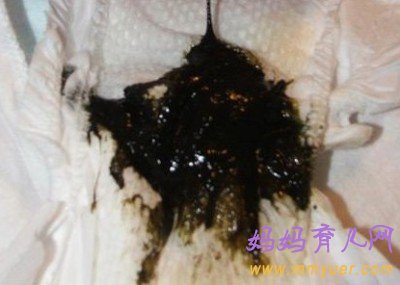 宝宝便便看出健康大问题