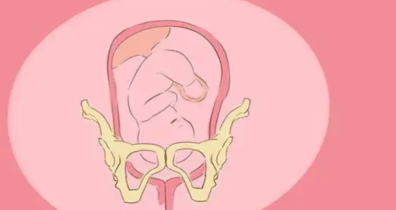 孕妇快走入盆快呀