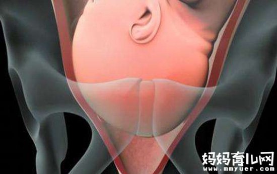 榆林产妇纵身一跃酿成悲剧 女人生孩子到底有多痛？