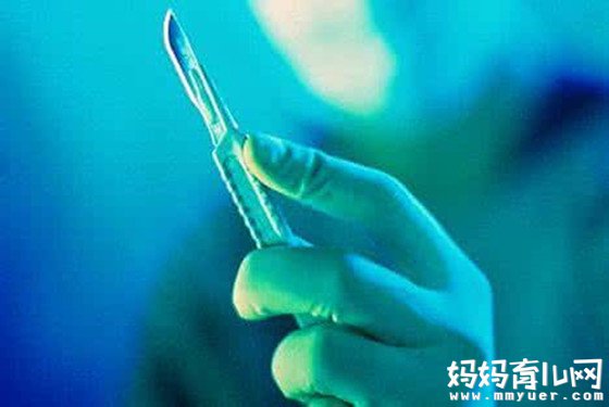 侧切伤口疼是在愈合吗 顺产侧切伤口疼怎么办
