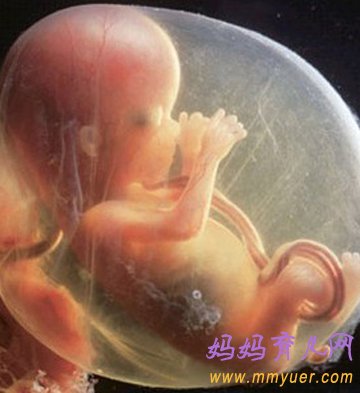 什么是脐带绕颈 脐带绕颈一周能顺产吗？