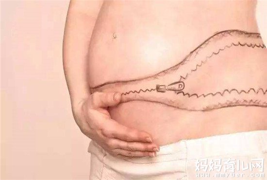 爱美的妈妈都在问同一个问题：剖腹产疤痕会完全消失吗