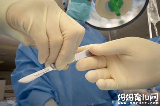 五年剖四胎被指作死 那剖腹产可以生三胎吗？