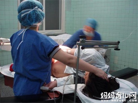 剖腹产怎么进行腹部美容 产后刀口护理这些错误不能犯