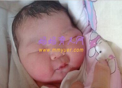 打麻药都不成功：剖腹产遇到实习医生 当了一回“小白鼠”