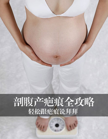 如何正确“对待”剖腹产疤痕带来的烦恼