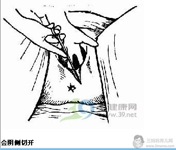 妈妈大谈顺产侧切缝伤口（图） - 顺产