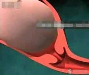 女人是怎么生孩子的？婴儿出生全过程（图解） - 顺产