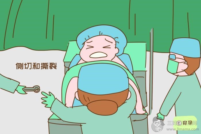 侧切和撕裂，必须选一个吗？想要顺产的妈妈要提前想好 - 顺产