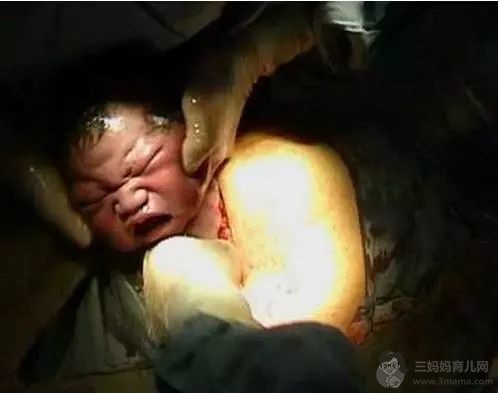 六张图带你看完顺产生娃的全过程，不是只有呐喊，等待更是难熬 - 顺产