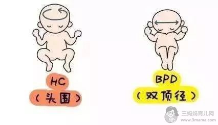 双顶径偏大，不能顺产么？ - 顺产