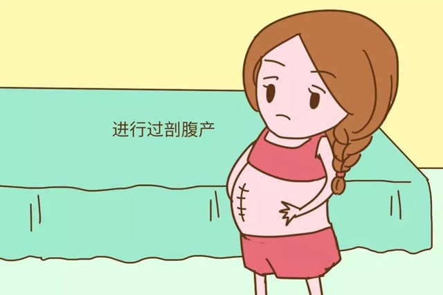 剖腹产疼吗