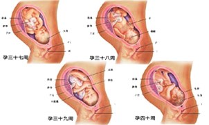 14周胎儿性别还会变吗