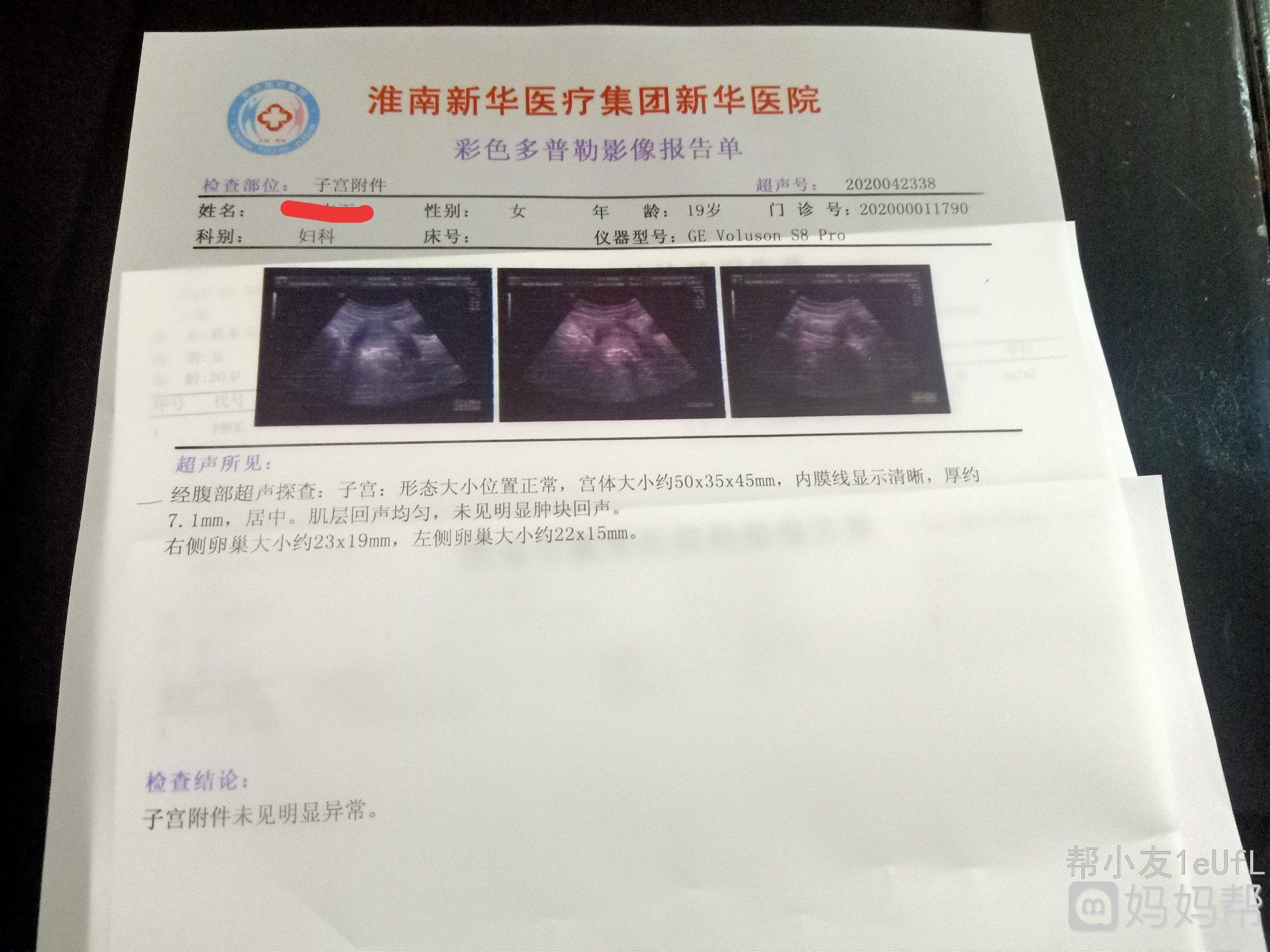 怀孕5周b超能看见吗
