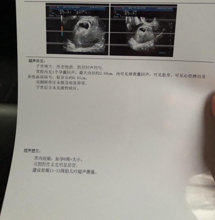 6周可以查胎心胎芽吗