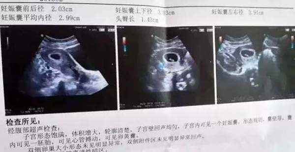 16周b超单性别图解图