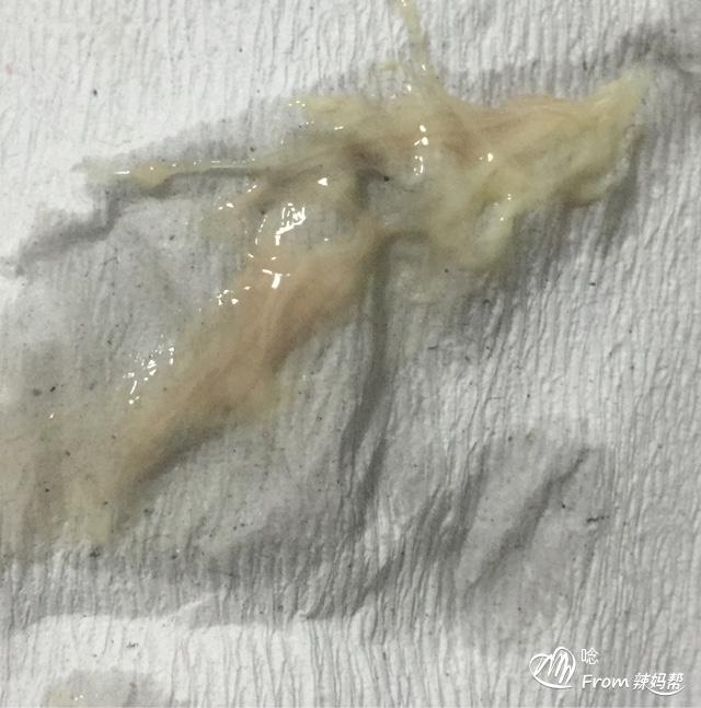 孕19周肚子发紧发撑