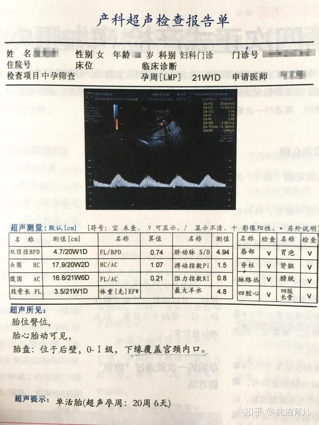 怀孕23周头围多少正常