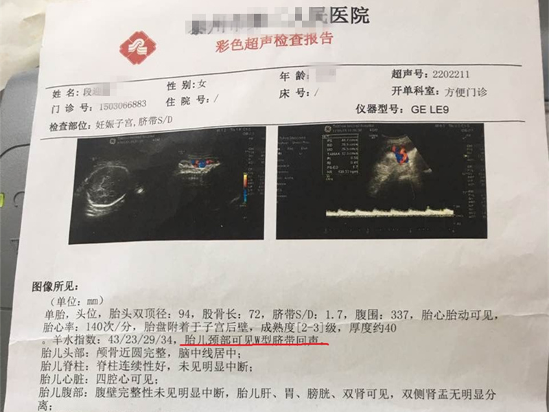 35周的胎儿那还没发育成熟