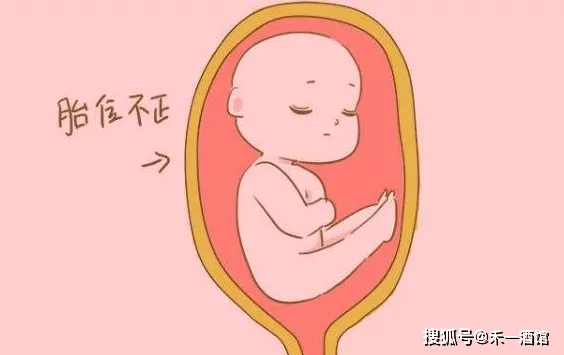 为什么孕35周突然胎位不正