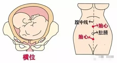 怀孕39周胎动几乎不动