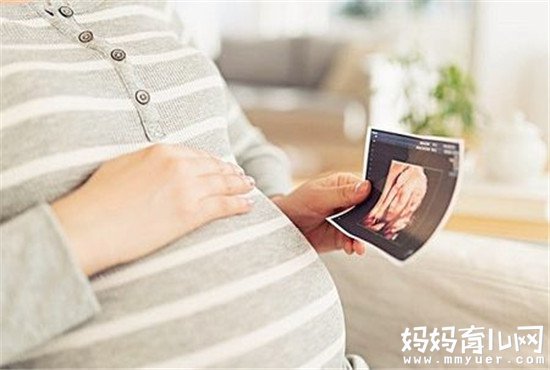 四维彩超和生下来像吗 99%的妈妈都是这么说的