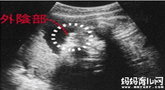 四维彩超怎么看男女的几个诀窍 一个比一个简单