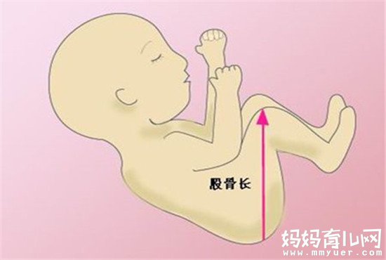 胎儿发育早知道：胎儿股骨短就代表腿短吗