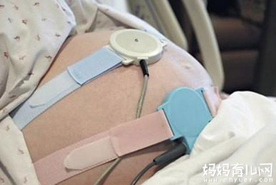 一般多少周做胎心监护 孕晚期做一次胎心监护多少钱？