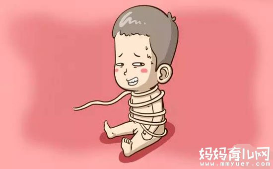 脐带绕颈两周怎么办有妙招  胎儿脱困就这么简单！
