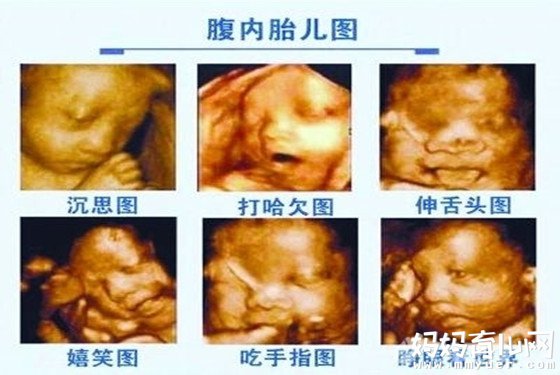 收费标准各不一样 究竟做一次四维彩超价格多少钱