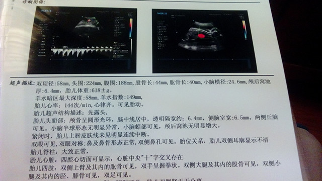 四维单子有暗示男女吗 亲手教你四维单子上怎么看m和f