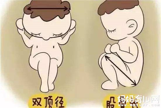 双顶径可不是头大头小那么简单 揭秘几个月看双顶径最准