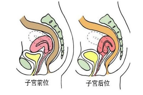 子宫前位是什么意思 子宫前位更容易受孕吗？