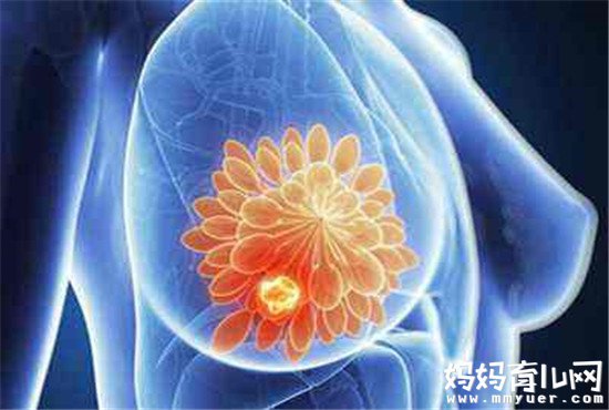 乳腺增生可以按摩缓解吗 简单易学的三种按摩手法