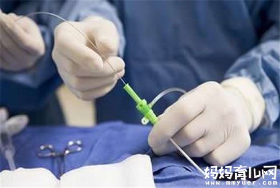 输卵管堵塞的症状有哪些 远远不止月经不调那么简单