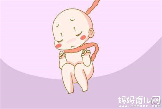 别一说脐带绕颈就乱了阵脚  支招脐带绕颈一周怎么办