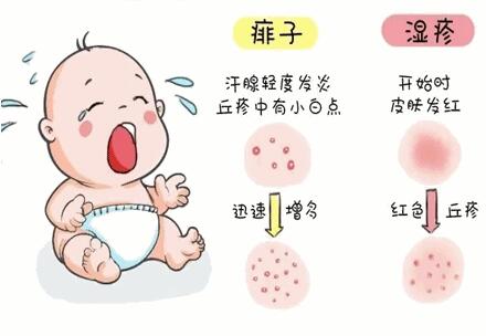 宝宝脸上长湿疹怎么办