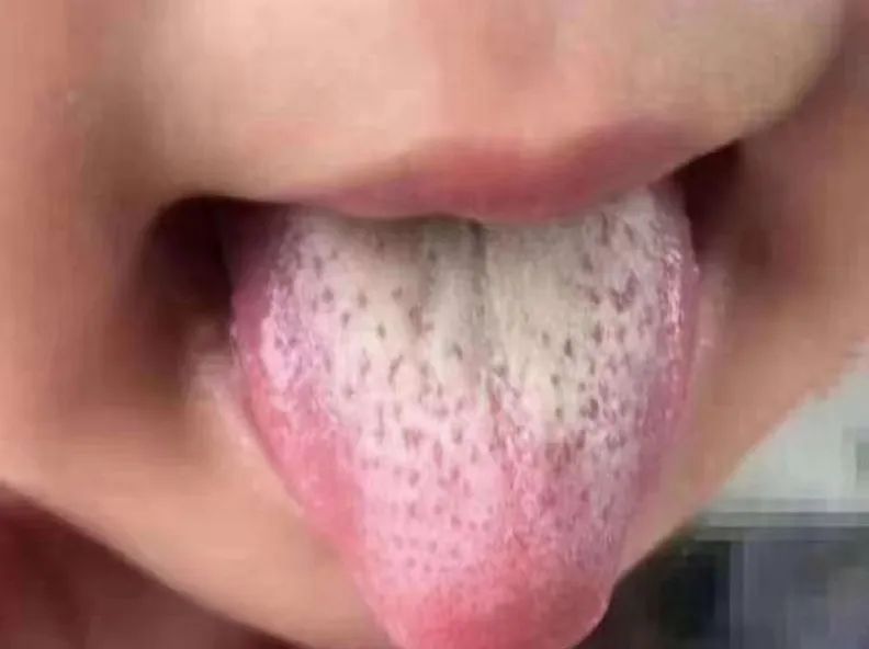 每天喝决明子茶减肥吗_喝什么茶减肥美容养颜_喝减肥茶宝宝健康