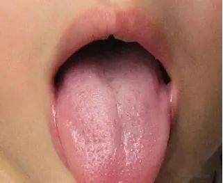 喝减肥茶宝宝健康_每天喝决明子茶减肥吗_喝什么茶减肥美容养颜