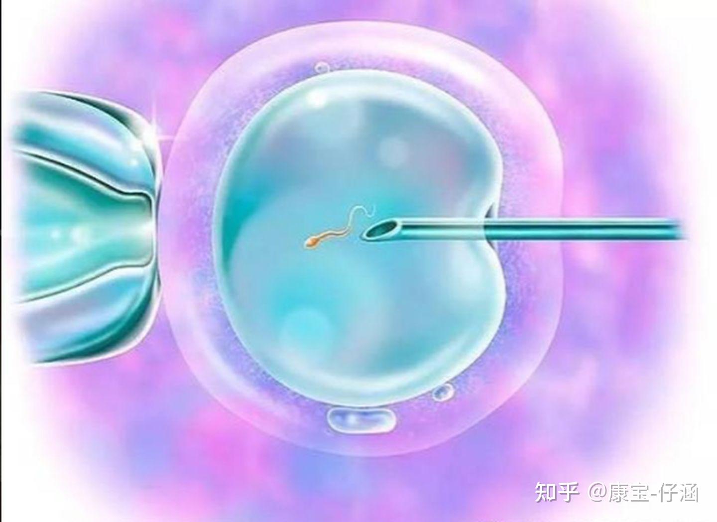 二代试管宝宝畸形率高吗_试管的宝宝健康吗_我的试管宝宝好聪明